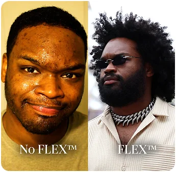 Before/After FLEX